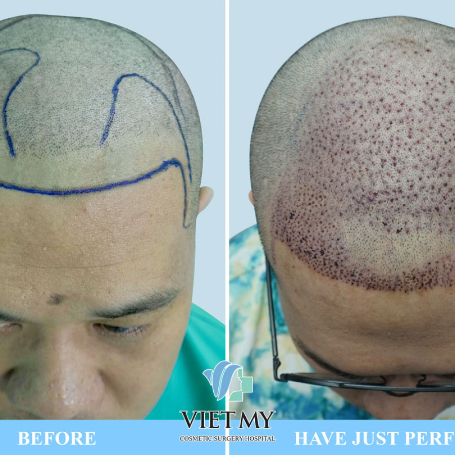 Viet My Plastic Surgery Hospital