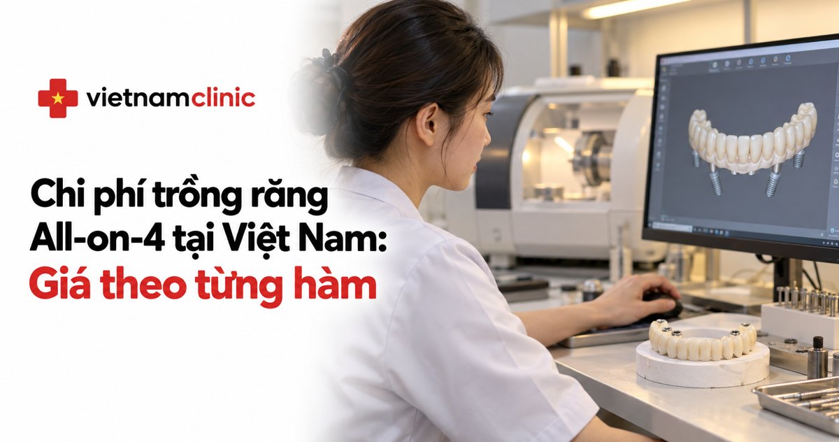 Chi phí trồng răng All-on-4: Giá theo từng hàm