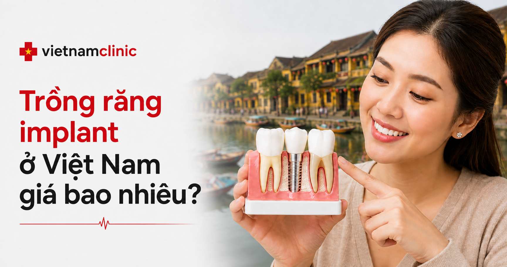 Trồng răng implant ở Việt Nam giá bao nhiêu?