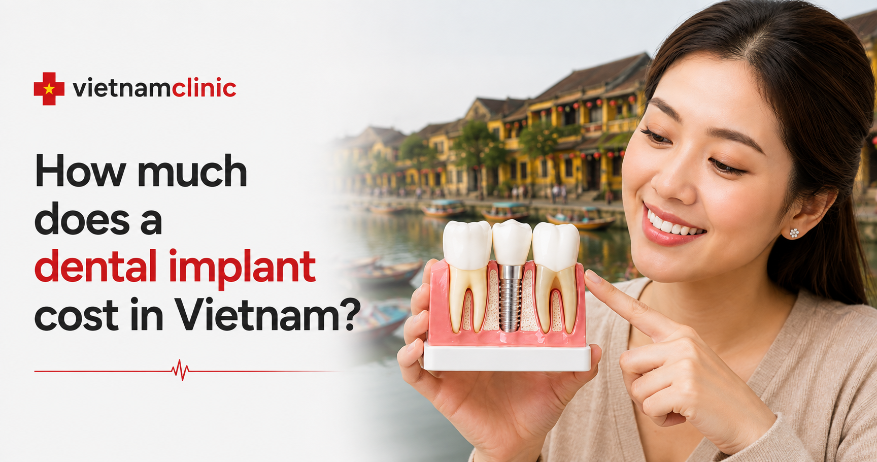 How much does a dental implant cost in Vietnam?